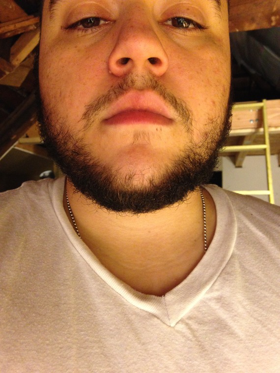 28 and growing after Chemo Beard Board