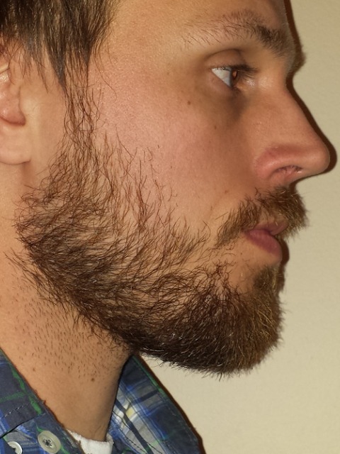 30 Y O First Time Upgrading From A Goatee 7 Week Update Page 2