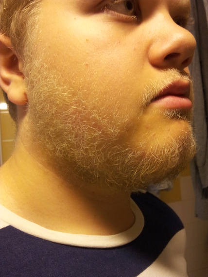 Vellus Hairs Beard